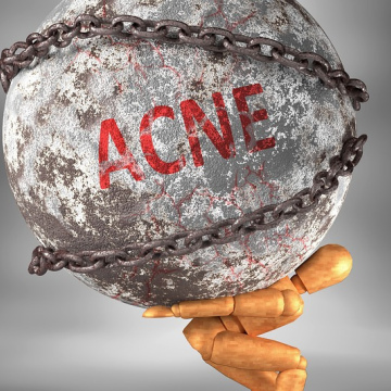 SOIN AUDIO SYNERGIE ENERGETIQUE PEAU/ACNE